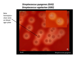 Streptococcus pyogenes (GAS)
Streptococcus agalactae (GBS)
Dr.Mohamed El Zowalaty-ENV 341 15
Beta
hemolytic=
clear zone
on blood
agar plate
 