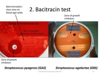 2. Bacitracin test
Dr.Mohamed El Zowalaty-ENV 341 16
Beta hemolytic=
clear zone on
blood agar plate
Zone of growth
inhibition
Zone of growth
inhibition
Streptococcus pyogenes (GAS) Streptococcus agalactae (GBS)
 
