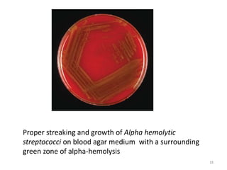 Dr Mohamed Ezzat-ENV 341 18
Proper streaking and growth of Alpha hemolytic
streptococci on blood agar medium with a surrounding
green zone of alpha-hemolysis
 