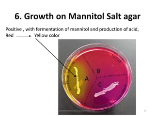 Positive , with fermentation of mannitol and production of acid,
Red Yellow color
6. Growth on Mannitol Salt agar
Dr.Mohamed El Zowalaty-ENV 341 8
 