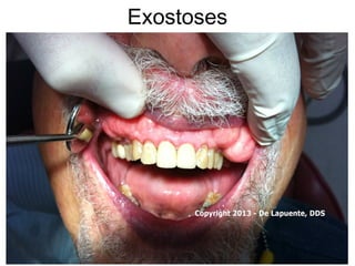 Practical oral diagnosis 2 | PPT