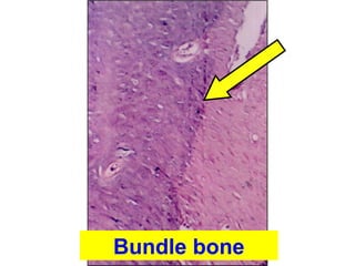 Bundle bone
 