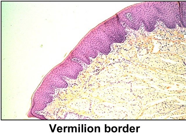 Vermilion Border Lip