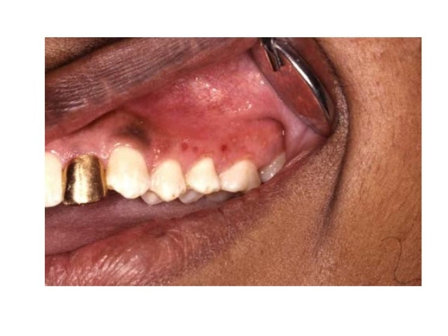 Practical oral medicine 2