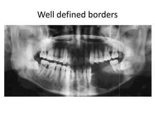 Well defined borders
 