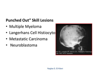 Naglaa S. El Kilani
136
Punched Out” Skill Lesions
• Multiple Myeloma
• Langerhans Cell Histiocytosis
• Metastatic Carcinoma
• Neuroblastoma
 