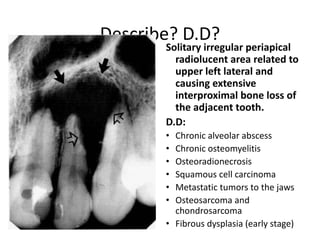 Describe? D.D?
• What is the D.D? Solitary irregular periapical
radiolucent area related to
upper left lateral and
causing extensive
interproximal bone loss of
the adjacent tooth.
D.D:
• Chronic alveolar abscess
• Chronic osteomyelitis
• Osteoradionecrosis
• Squamous cell carcinoma
• Metastatic tumors to the jaws
• Osteosarcoma and
chondrosarcoma
• Fibrous dysplasia (early stage)
 