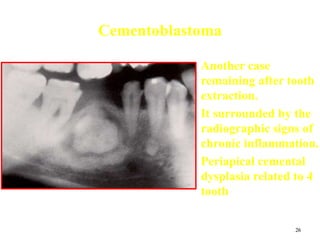 26
Cementoblastoma
• Another case
remaining after tooth
extraction.
• It surrounded by the
radiographic signs of
chronic inflammation.
• Periapical cemental
dysplasia related to 4
tooth
 
