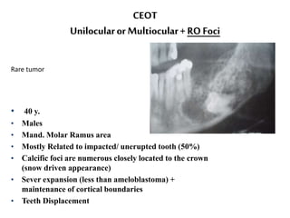 CEOT
Unilocularor Multiocular+ RO Foci
• 40 y.
• Males
• Mand. Molar Ramus area
• Mostly Related to impacted/ unerupted tooth (50%)
• Calcific foci are numerous closely located to the crown
(snow driven appearance)
• Sever expansion (less than ameloblastoma) +
maintenance of cortical boundaries
• Teeth Displacement
Rare tumor
 