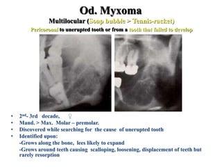 Od. Myxoma
Multilocular (Soap bubble > Tennis-racket)
Pericoronal to unerupted tooth or from a tooth that failed to develop
• 2nd- 3rd decade, ♀
• Mand. > Max. Molar – premolar.
• Discovered while searching for the cause of unerupted tooth
• Identified upon:
-Grows along the bone, lees likely to expand
-Grows around teeth causing scalloping, loosening, displacement of teeth but
rarely resorption
 