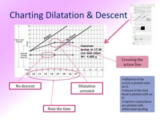 Charting Dilatation & Descent



                                           Crossing the
                                            action line


                                           diltation of the
                                           cervix is plotted with
 No descent                   Dilatation   an X ,
                              arrested     desent of the fetal
                                           head is plotted with an
                                           O
                                           uterine contractions
                                           are plotted with
              Note the time                differential shading
 