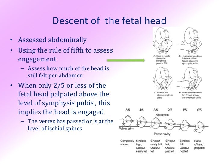 Fetal Head Engagement Chart
