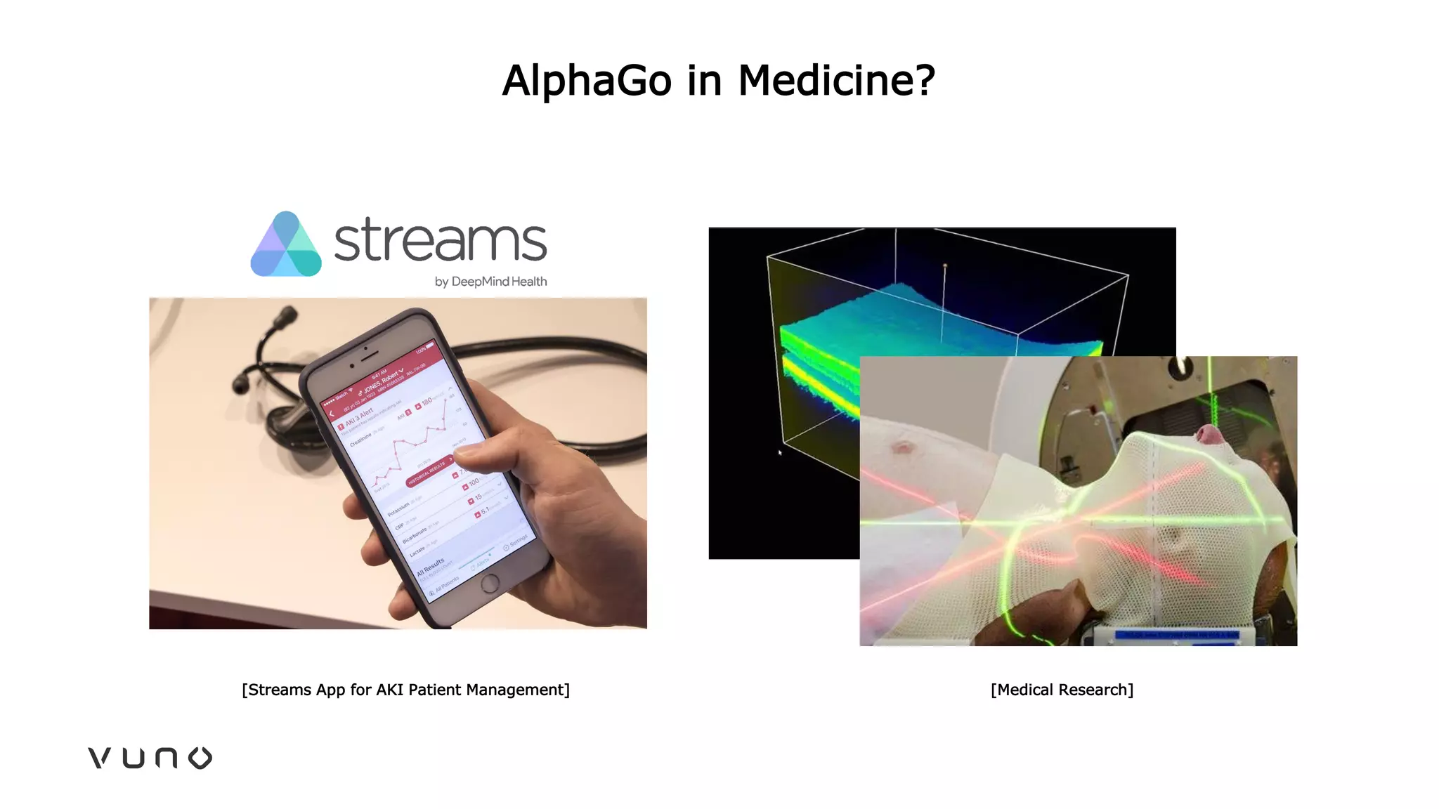 AlphaGo in Medicine?
[Streams App for AKI Patient Management] [Medical Research]
 