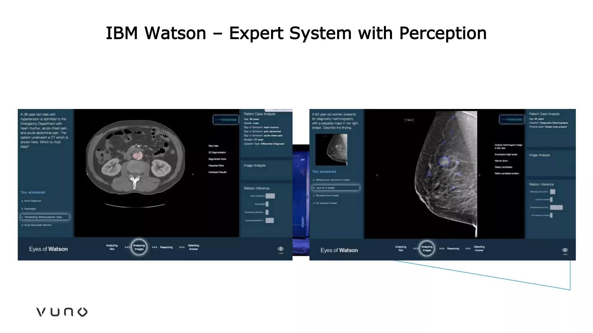 IBM Watson – Expert System with Perception
 