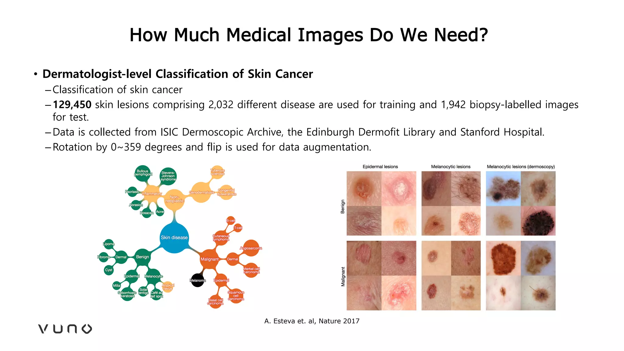 How Much Medical Images Do We Need?
• Dermatologist-level Classification of Skin Cancer
–Classification of skin cancer
–129,450 skin lesions comprising 2,032 different disease are used for training and 1,942 biopsy-labelled images
for test.
–Data is collected from ISIC Dermoscopic Archive, the Edinburgh Dermofit Library and Stanford Hospital.
–Rotation by 0~359 degrees and flip is used for data augmentation.
A. Esteva et. al, Nature 2017
 