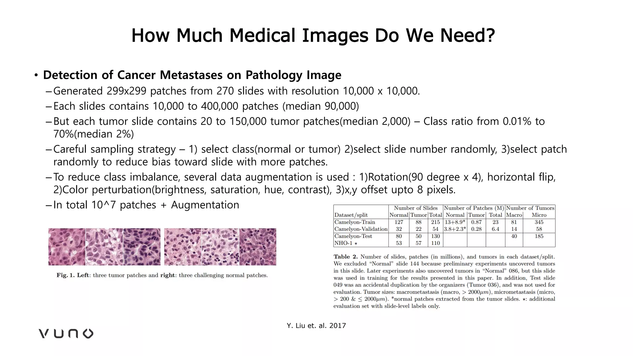 How Much Medical Images Do We Need?
• Detection of Cancer Metastases on Pathology Image
–Generated 299x299 patches from 270 slides with resolution 10,000 x 10,000.
–Each slides contains 10,000 to 400,000 patches (median 90,000)
–But each tumor slide contains 20 to 150,000 tumor patches(median 2,000) – Class ratio from 0.01% to
70%(median 2%)
–Careful sampling strategy – 1) select class(normal or tumor) 2)select slide number randomly, 3)select patch
randomly to reduce bias toward slide with more patches.
–To reduce class imbalance, several data augmentation is used : 1)Rotation(90 degree x 4), horizontal flip,
2)Color perturbation(brightness, saturation, hue, contrast), 3)x,y offset upto 8 pixels.
–In total 10^7 patches + Augmentation
Y. Liu et. al. 2017
 