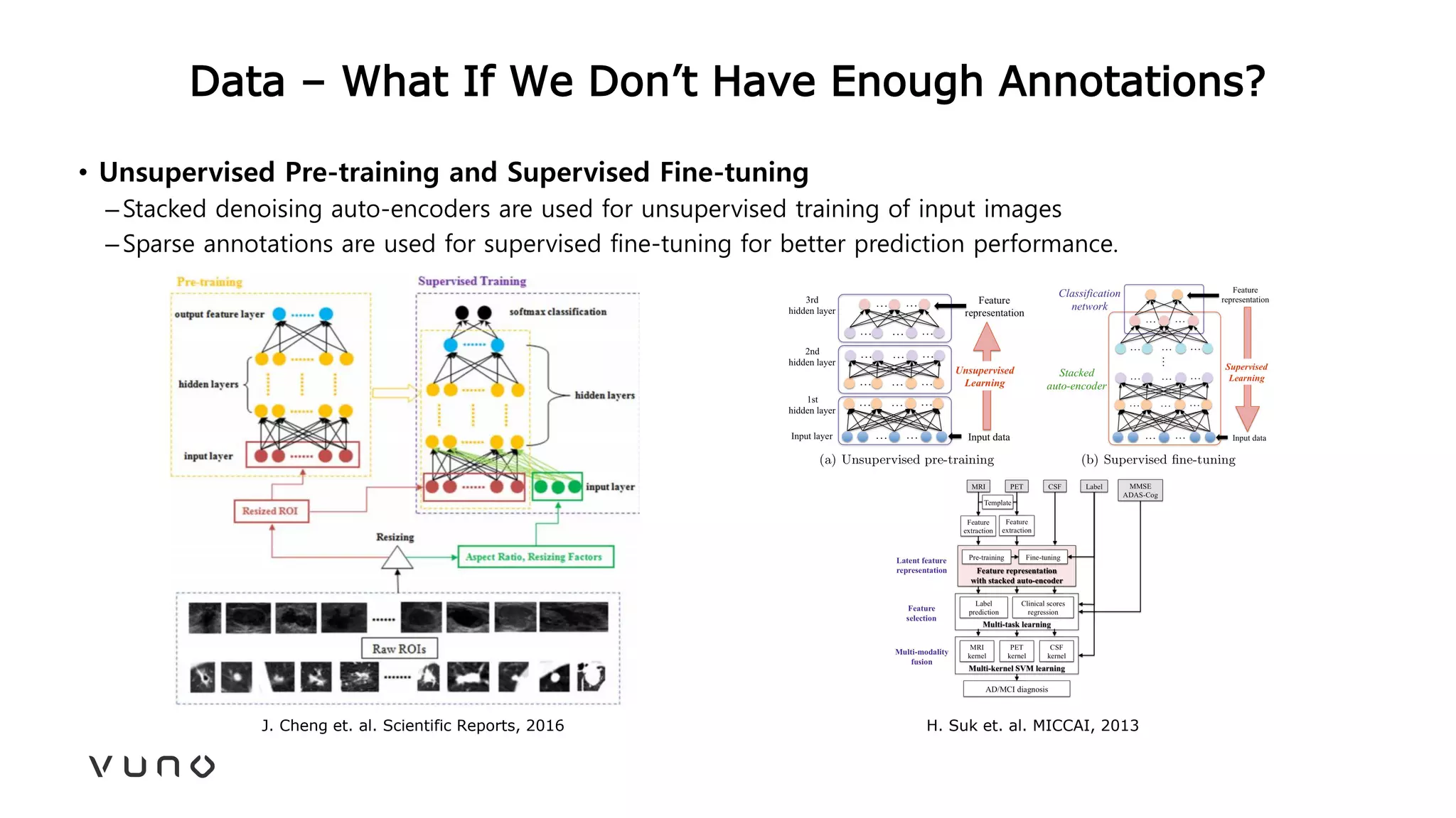 Data – What If We Don’t Have Enough Annotations?
• Unsupervised Pre-training and Supervised Fine-tuning
–Stacked denoising auto-encoders are used for unsupervised training of input images
–Sparse annotations are used for supervised fine-tuning for better prediction performance.
J. Cheng et. al. Scientific Reports, 2016 H. Suk et. al. MICCAI, 2013
 