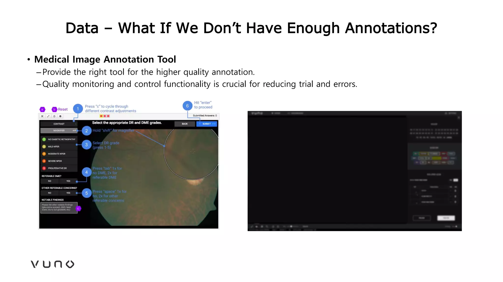 Data – What If We Don’t Have Enough Annotations?
• Medical Image Annotation Tool
–Provide the right tool for the higher quality annotation.
–Quality monitoring and control functionality is crucial for reducing trial and errors.
 