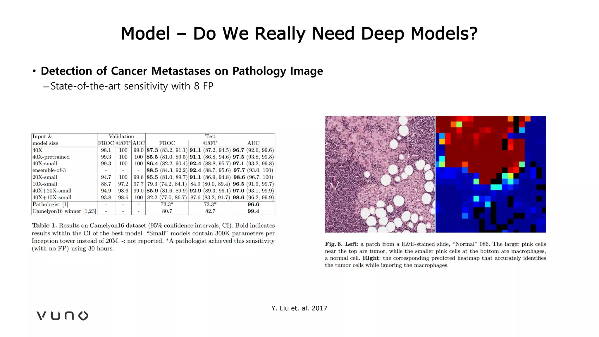 Model – Do We Really Need Deep Models?
• Detection of Cancer Metastases on Pathology Image
–State-of-the-art sensitivity with 8 FP
Y. Liu et. al. 2017
 