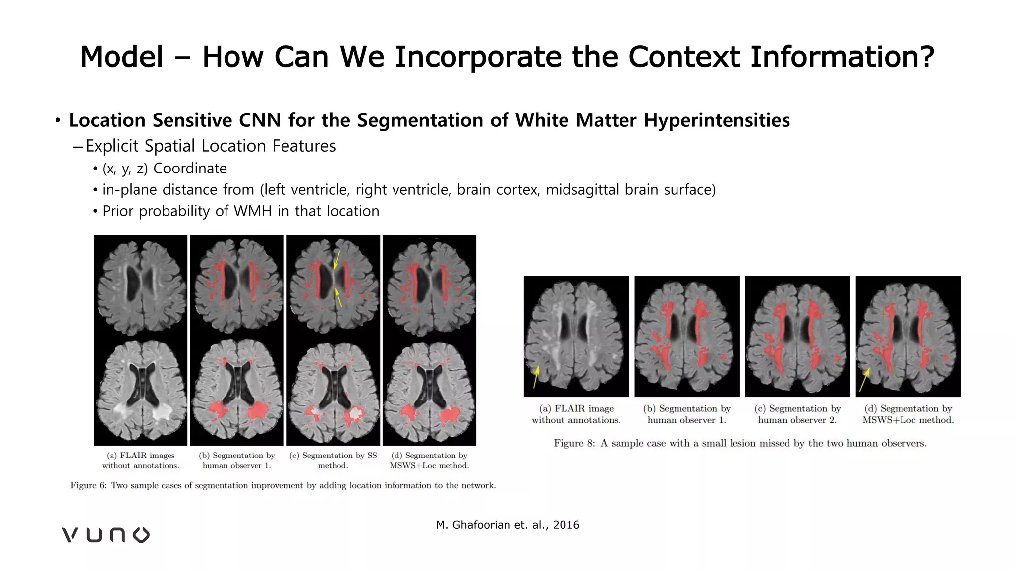Model – How Can We Incorporate the Context Information?
• Location Sensitive CNN for the Segmentation of White Matter Hyperintensities
–Explicit Spatial Location Features
• (x, y, z) Coordinate
• in-plane distance from (left ventricle, right ventricle, brain cortex, midsagittal brain surface)
• Prior probability of WMH in that location
M. Ghafoorian et. al., 2016
 