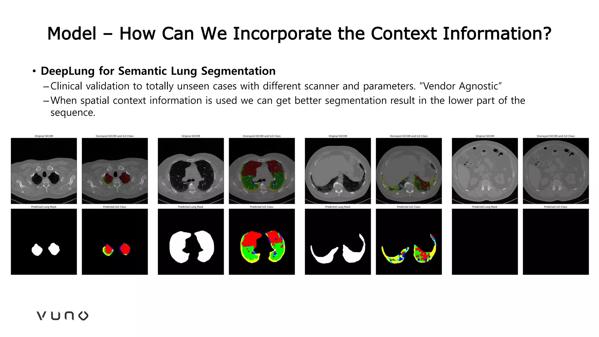 Model – How Can We Incorporate the Context Information?
• DeepLung for Semantic Lung Segmentation
–Clinical validation to totally unseen cases with different scanner and parameters. “Vendor Agnostic”
–When spatial context information is used we can get better segmentation result in the lower part of the
sequence.
 