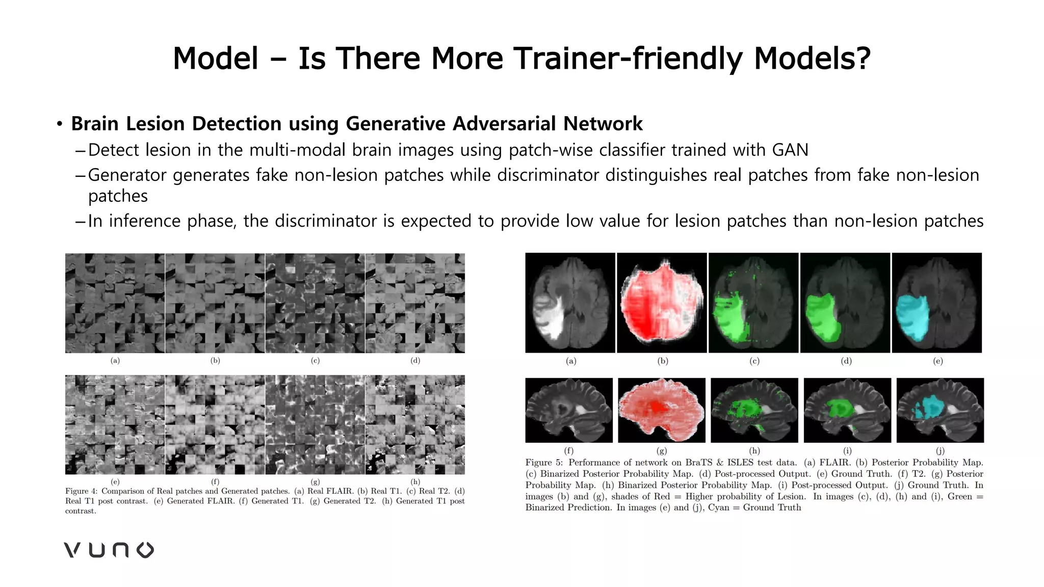 Model – Is There More Trainer-friendly Models?
• Brain Lesion Detection using Generative Adversarial Network
–Detect lesion in the multi-modal brain images using patch-wise classifier trained with GAN
–Generator generates fake non-lesion patches while discriminator distinguishes real patches from fake non-lesion
patches
–In inference phase, the discriminator is expected to provide low value for lesion patches than non-lesion patches
 
