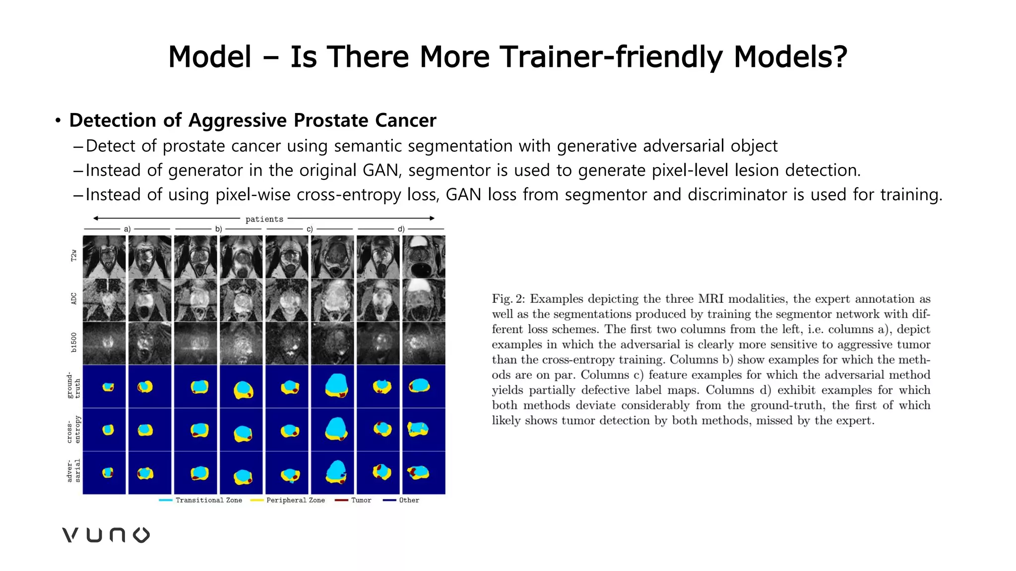 Model – Is There More Trainer-friendly Models?
• Detection of Aggressive Prostate Cancer
–Detect of prostate cancer using semantic segmentation with generative adversarial object
–Instead of generator in the original GAN, segmentor is used to generate pixel-level lesion detection.
–Instead of using pixel-wise cross-entropy loss, GAN loss from segmentor and discriminator is used for training.
 