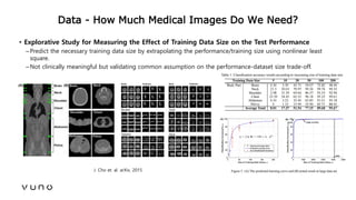 (2017/06)Practical points of deep learning for medical imaging Slide 40
