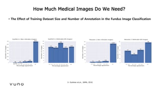 (2017/06)Practical points of deep learning for medical imaging Slide 42