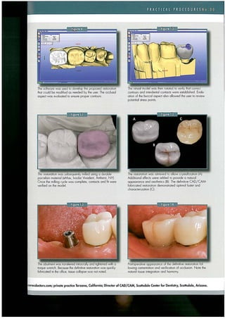 Practical procedures nr.30