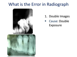 Practical radiographs | PPTX