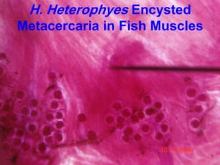 H. Heterophyes Encysted
Metacercaria in Fish Muscles
 