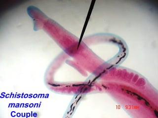 Schistosoma
mansoni
Couple
 