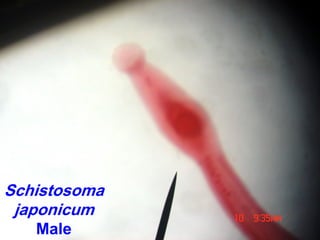 Schistosoma
japonicum
Male
 