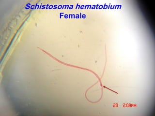 Schistosoma hematobium
Female
 