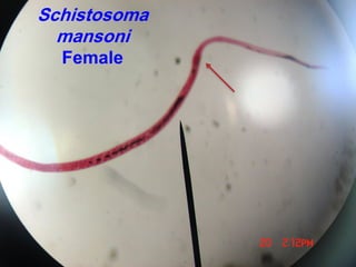 Schistosoma
mansoni
Female
 
