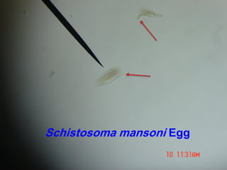 Schistosoma mansoni Egg
 