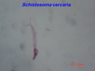 Schistosoma cercaria
 
