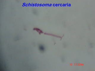 Schistosoma cercaria
 