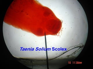 Taenia Solium Scolex
 