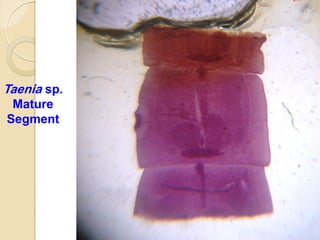 Taenia sp.
Mature
Segment
 