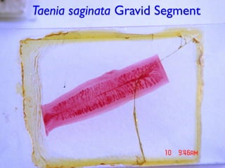 Taenia saginata Gravid Segment
 