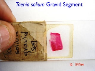 Taenia solium Gravid Segment
 