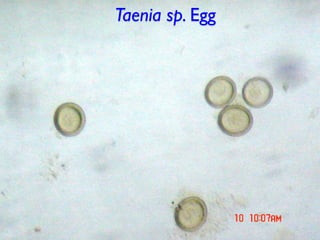 Taenia sp. Egg
 
