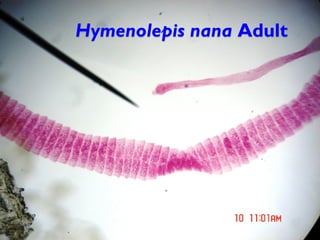 Hymenolepis nana Adult
 