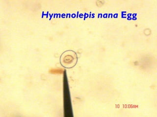 Hymenolepis nana Egg
 