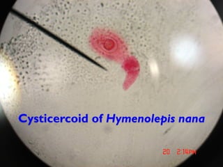 Cysticercoid of Hymenolepis nana
 