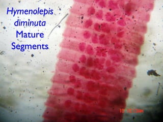 Hymenolepis
diminuta
Mature
Segments
 