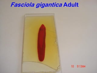 Fasciola gigantica Adult
 
