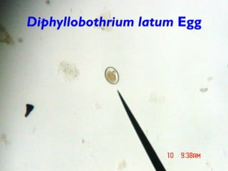 Diphyllobothrium latum Egg
 